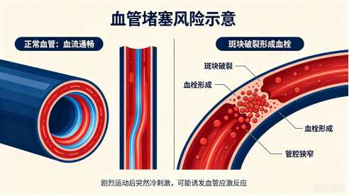 血管堵塞