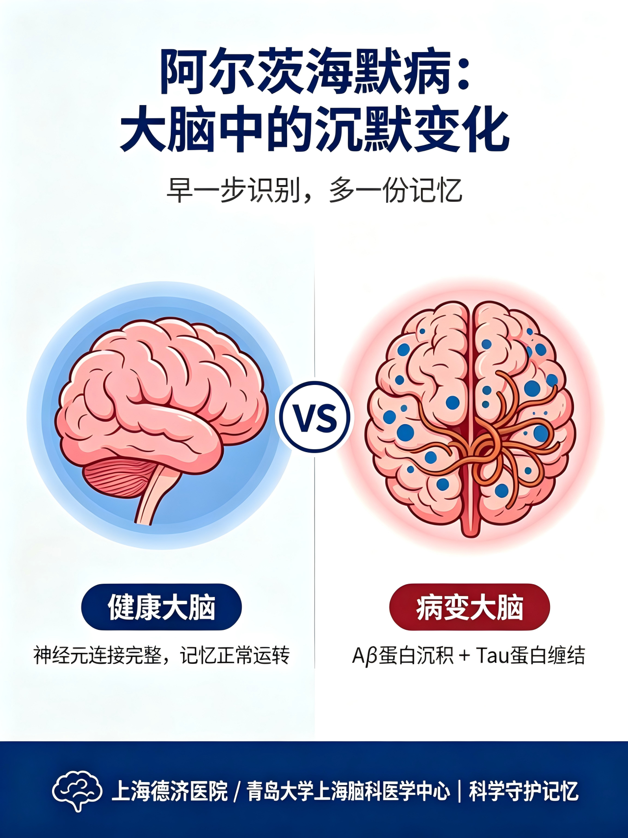 阿尔茨海默病